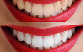 Odontología Estética