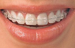 Ortodoncia y Ortopedia Maxilar