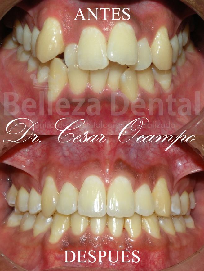 Casos Clínicos Ortodoncia