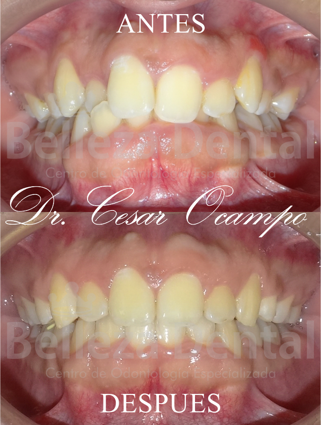 Casos Clínicos Ortodoncia