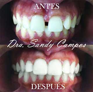 Casos Clinicos Ortodoncia