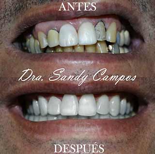 Casos Clinicos Ortodoncia