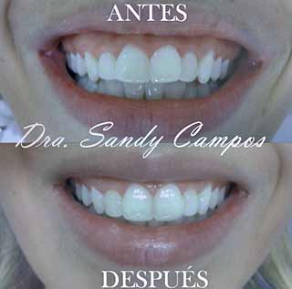 Casos Clinicos Ortodoncia