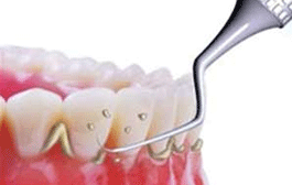 Periodoncia