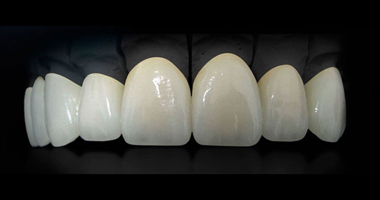 Rehabilitación Oral