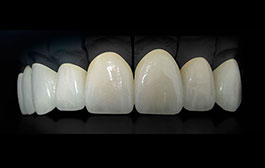 Ortodoncia y Ortopedia Maxilar